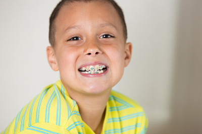 Young child around age 7 beginning early orthodontic evaluation